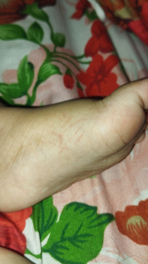 kira kira dan obatnya