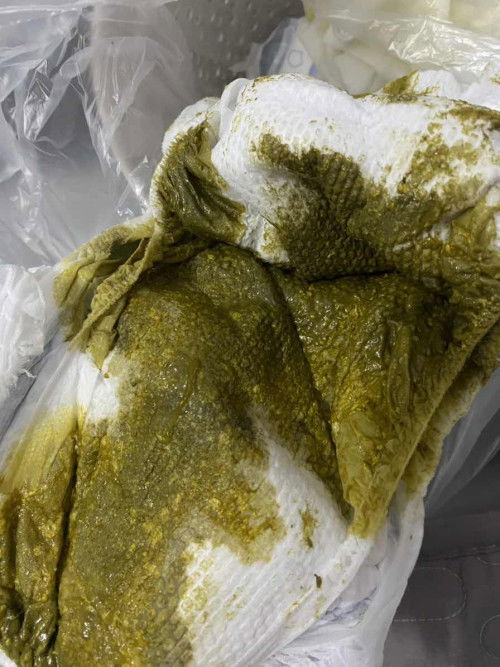 น้อง5เดือน24วัน อึแบบนี้ปกติไหมคะ