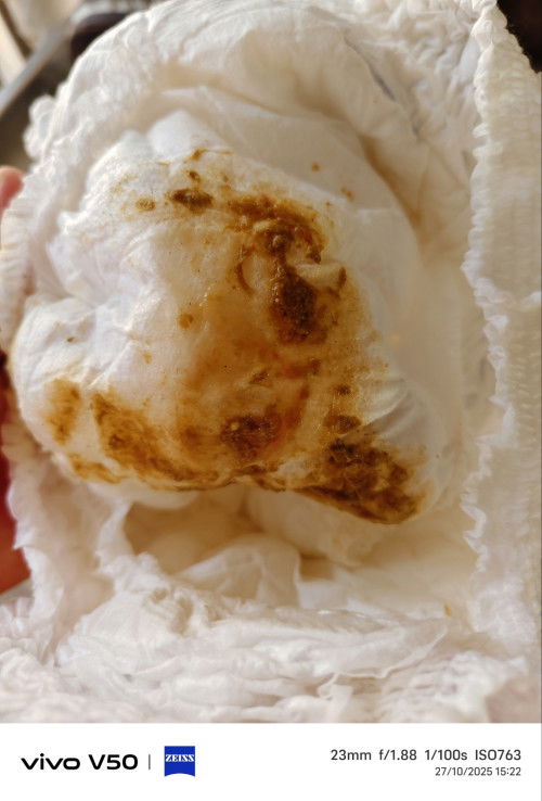 #ขออนุญาติสอบถามแม่ๆนะคะ