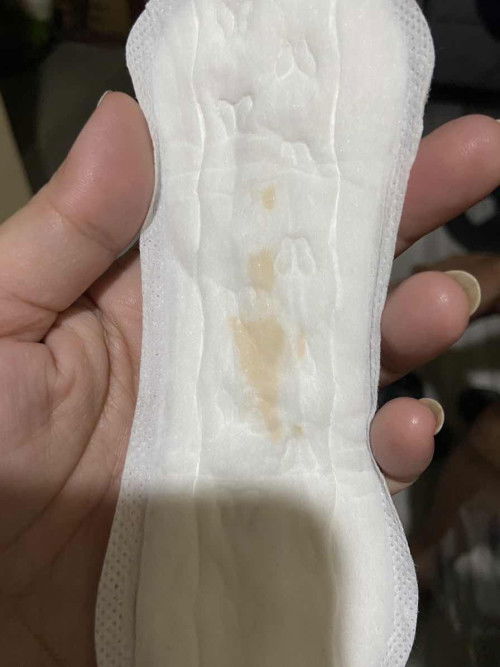 Implantation bleeding???