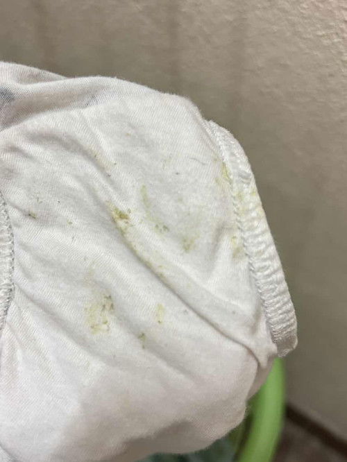 ลูกสาว4ขวบมีตกขาว