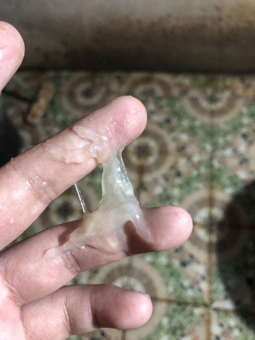 38วีคมีแบบนี้ไหลออก3วันแล้วแบบนี้อันตรายมั้ยคะแม่ๆไม่มีอาการท้องปั้นแข็งใดๆ