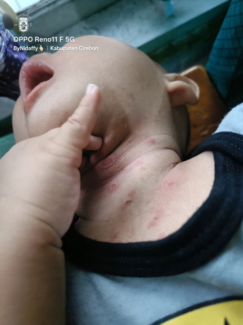 Bund cacar bkn ya ini...