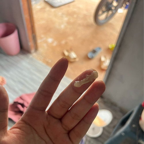 วันนี้บ่าย3มีมูกแบบนี้ออกมากี่วันคลอด