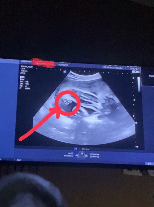 แม่ๆว่าแบบนี้คือเพศอะไรคะ?