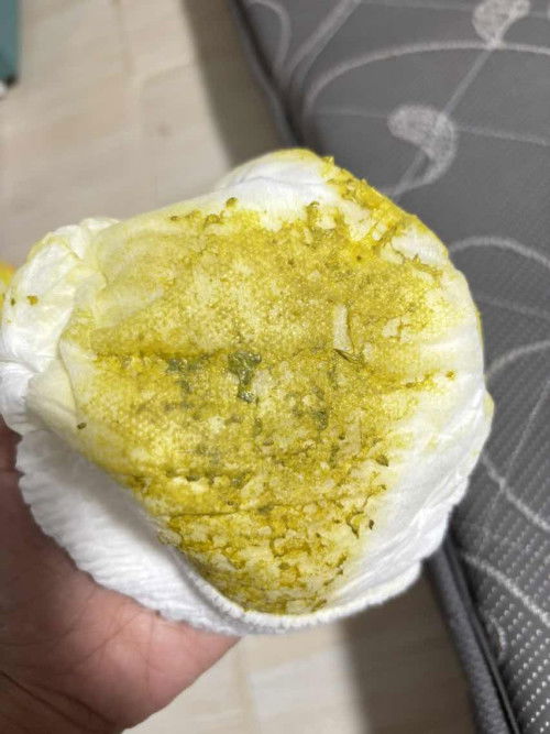 สอบถามเรื่องอุจจาระค่ะ