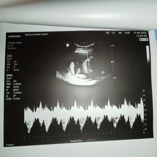 อยากรู้ว่า น้องเป็นเพศชายจริงๆมั้ย!!