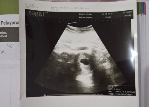 Sudah 6w6d rasa mual sangat berkurang dan seperti tidak merasa hamil apakah wajar?