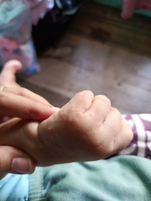 Bunda anaku usia 2 bulan tiba2 kayak gini obatnya apa yah dan penyebabnya apa yah