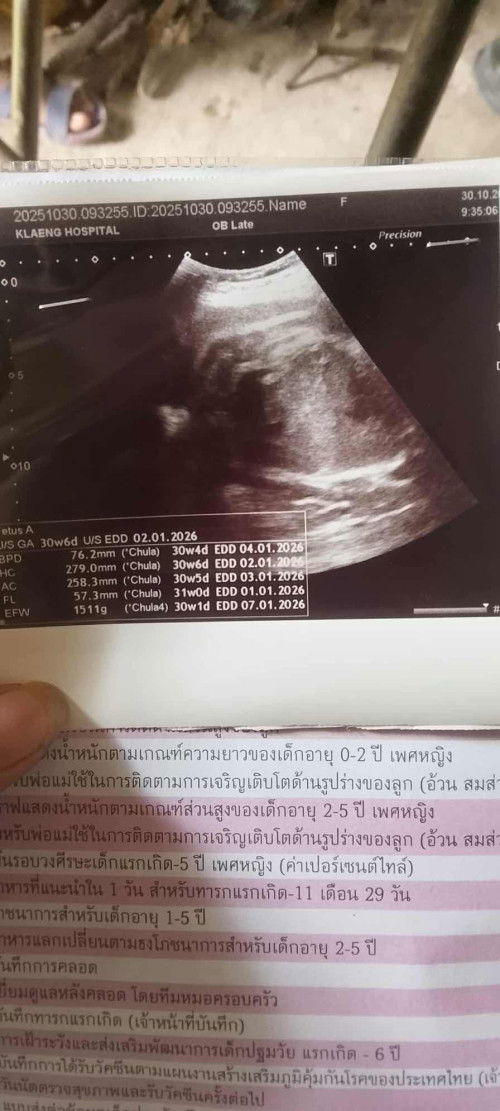 31w5วัน นน.น้อง 1511g ปกติมั้ยคะ
แม่ๆกี่วีคกันแล้วบ้าง
น้ำหนักน้องเท่าไหร่กันบ้างคะ กลัวลูกน้ำหนักน้อย🥹