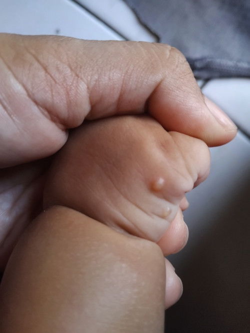 Kira² 2 bentolan ini apa ya bund?