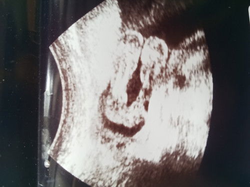 เเบบนี้เพศอะไรหรอคะะ