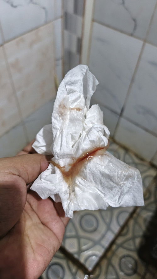 Keluar flek setelah HB