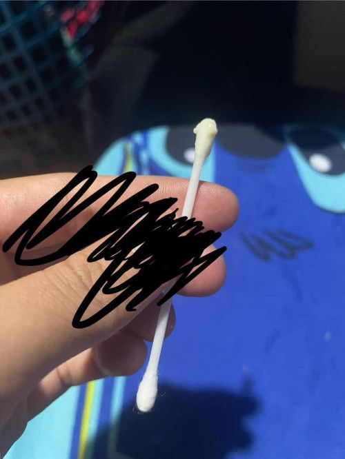 ตกขาวแบบนี้ปกตไหมคะ