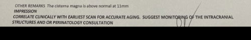 Enlarged Cisterna Magna