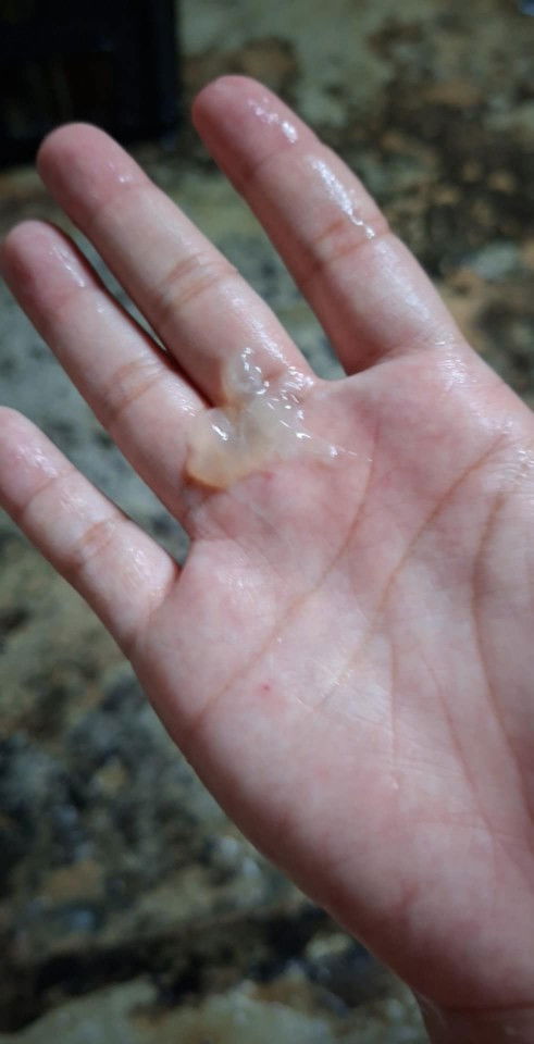 ใช่มูกใสไหมคะ