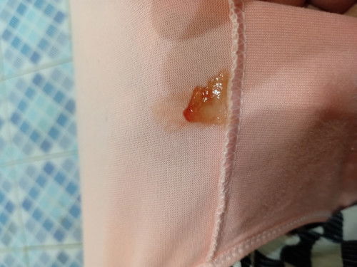 มูกเลือดแบบนี้