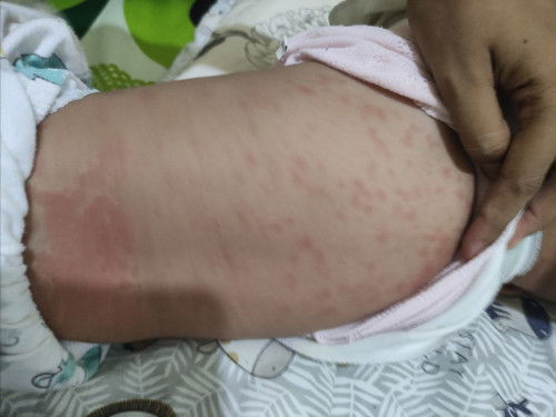 bayi umur 7 bulan lebih