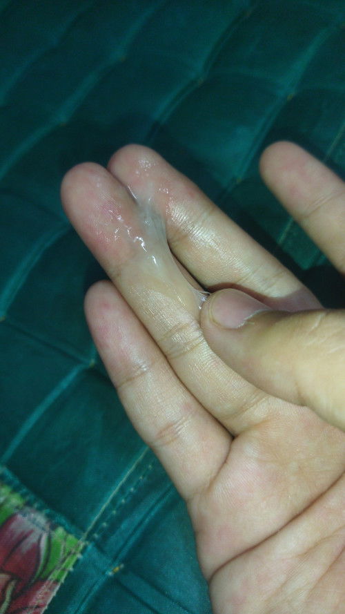 Kalau kluar lendir MCM telur ni tanda APA ya sy baru 35 week 5 Hari dgn sakit perut mngeras bhgian