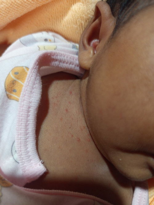 น้องอายุ 16วัน ค่ะ