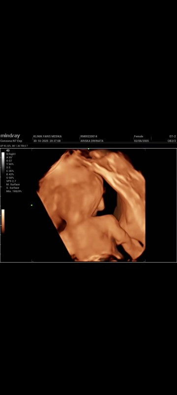 Janin tidak menunjukkan wajah saat usg