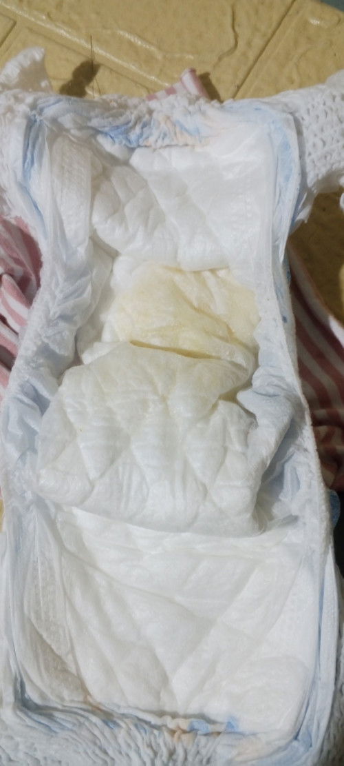 Dehydrated po Kya si baby may uti