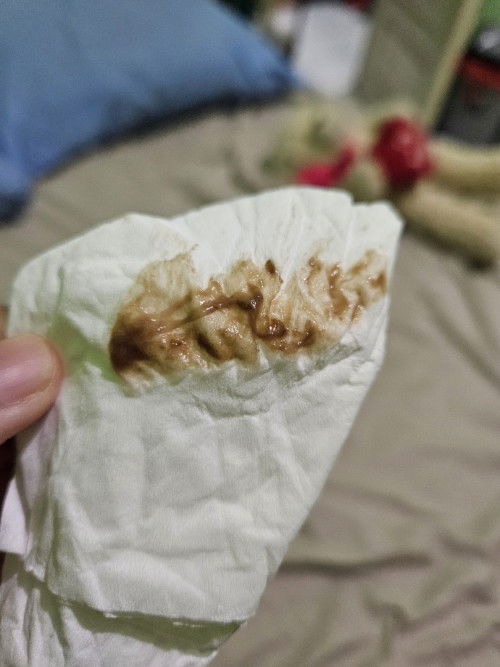 Bunda bantu jawab dong.. 
Saya kan 9week terus keluar flek coklat, udah di usg tapi ttp ovt .