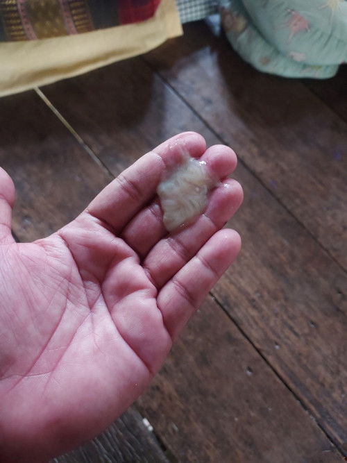 ท้อง39วีคมีอาการปวดหน่วงตรงจิมิมากแล้วมีมูกไหลออกมาแบบนี้จะเป็นอะไรไหมคะ