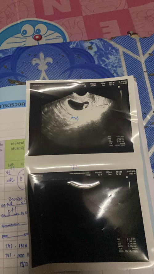 ภาพนี้ซาวตอน8วีค