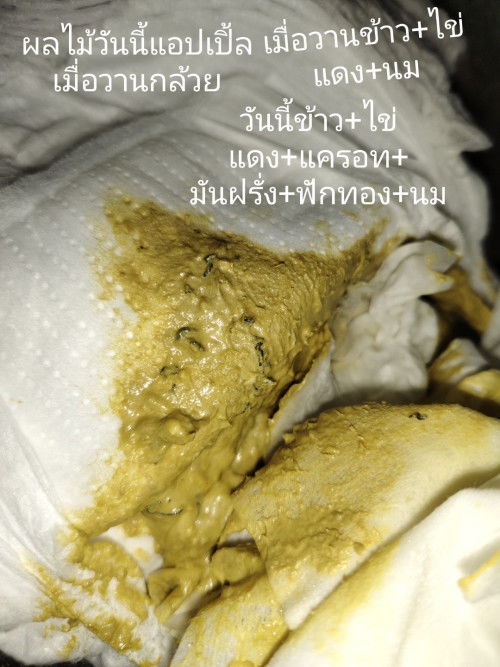 อึลูกเป็นแบบนี้เกิดจากอะไร