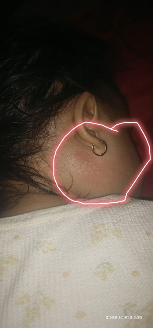 Mau tanya anak umur 2 tahun pipi tiba tiba bengkak sebelah