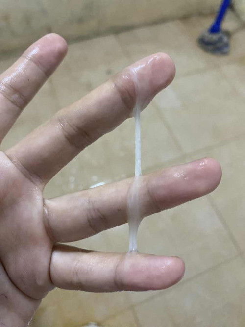 แม่ๆคะพอดีอยากทราบว่าอันนี้มูกใสหรือตกขาวคะ