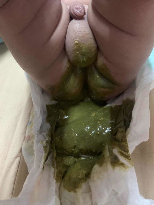 แม่ๆแนะนำหน่อยคะกังวน