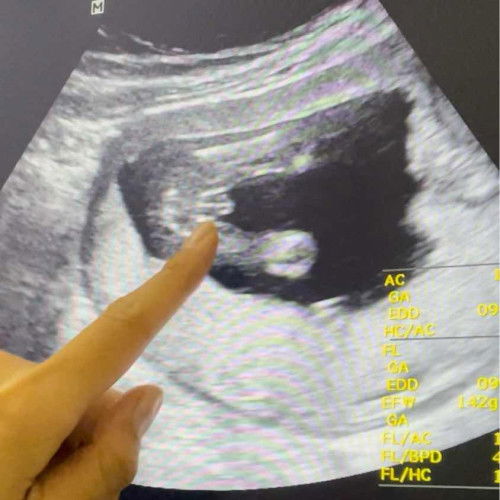 สอบถามค่ะ เพศหญิงหรือชายคะ