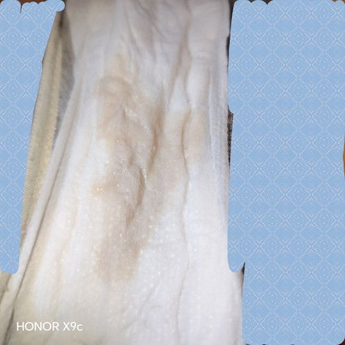 Hai momy",Nakk Tanya, perut kerap mengeras, And keluar air ketuban Lumayan sikit"