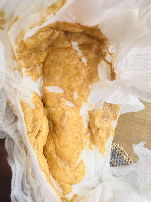 ลูก5เดือนท้องเสียไปหาหมอสองรอบไม่ดีขึ้น