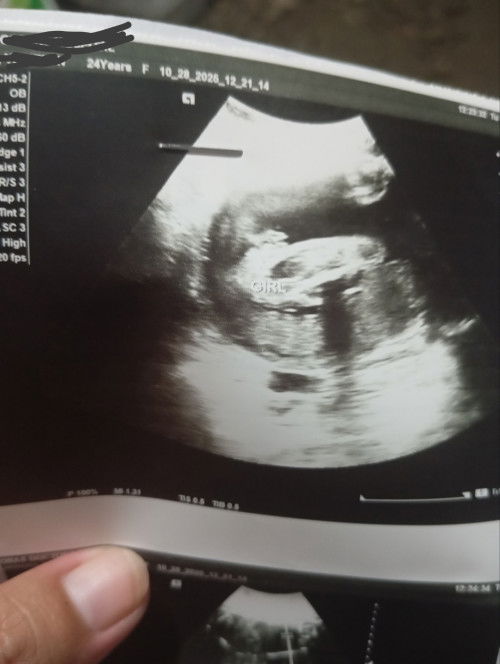 Legit kaya Na baby girl to?