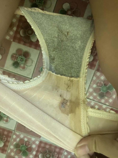 ตกขาวสีนํ้าตาล