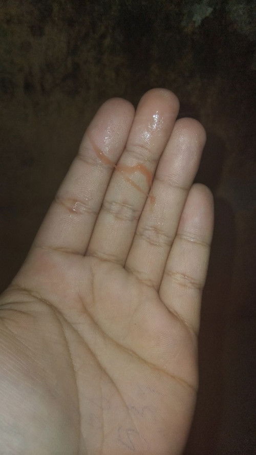 แบบนี้ท้องมั้ยค่ะ