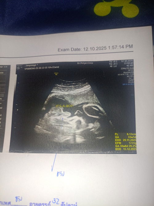 ได้ลูกชายจริงๆไหม