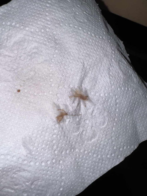 10w5d. Mcm ni perlu ke klinik segera ka?