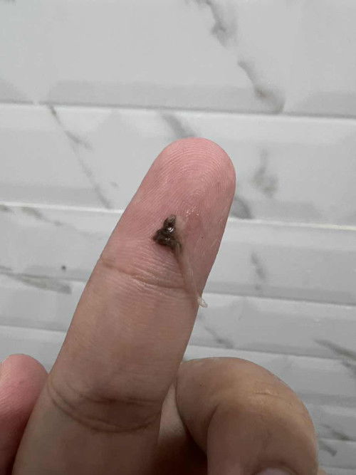 Flek/mau haid atau keguguran dini?