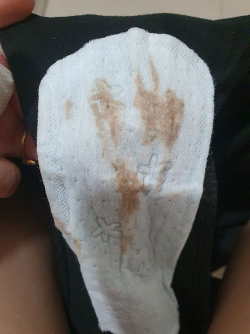 คราบสีน้ำตาล