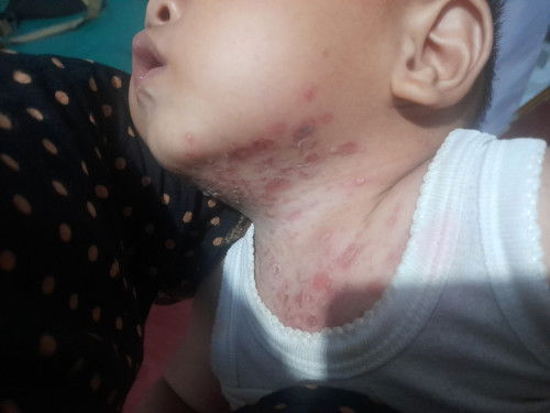 Solusi atau cara mengobati