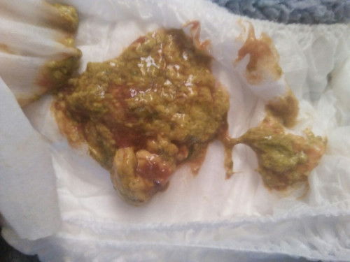 Mau tanya maaf jika jorok, kalau pup bayi umur 6bulan jln 7ini kenapa ya? Soalnya baru anak pertama.