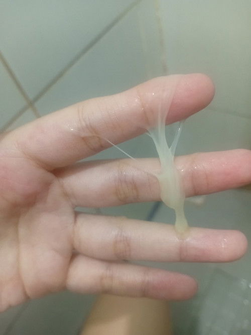 22 weeks keputihan lendir seperti ingus