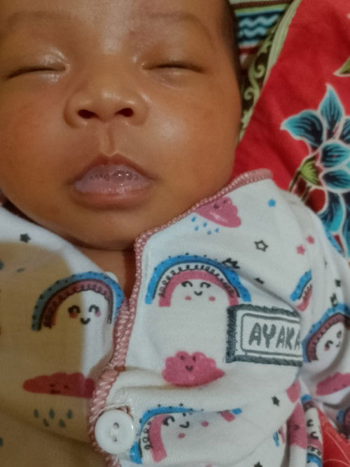 Bayi 24 hari bibirnya kaya gini KLO abis nyusu
Normal GK sih bunda2 mohon jawabannya