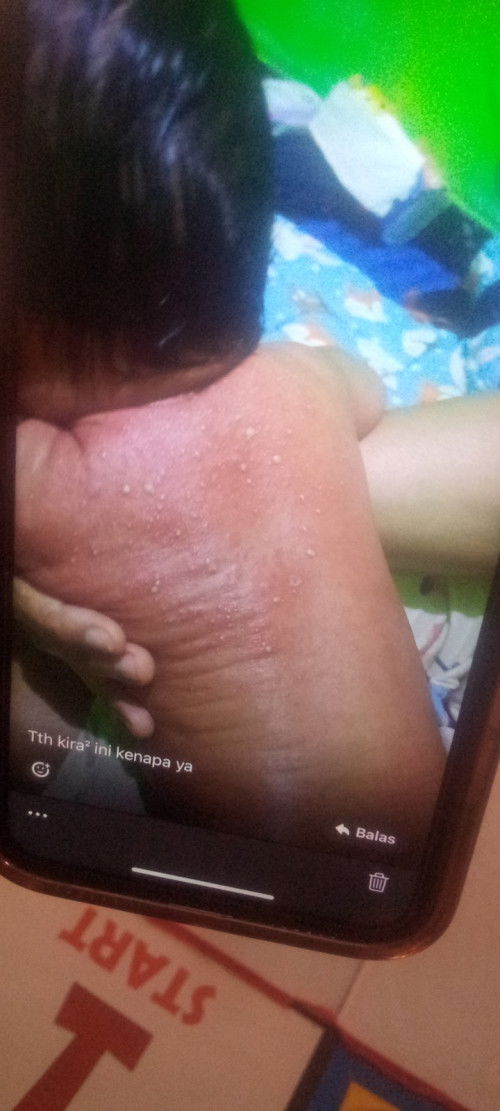 Bund kira kira ini knpa ya dan gmana cara ngatasin ny