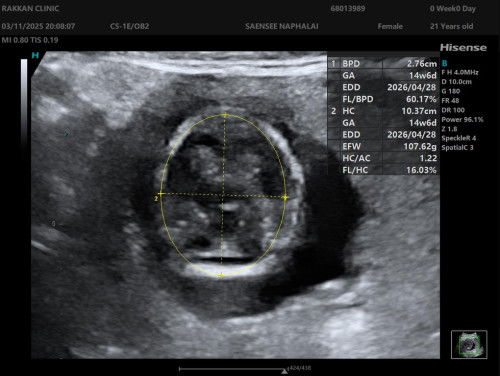 แม่ๆคะช่วยน้ำหนักน้อง107กรัม