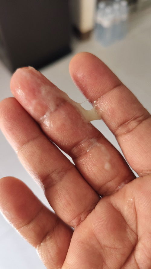 แบบนี้มูกหรือตกขาวคะ😂